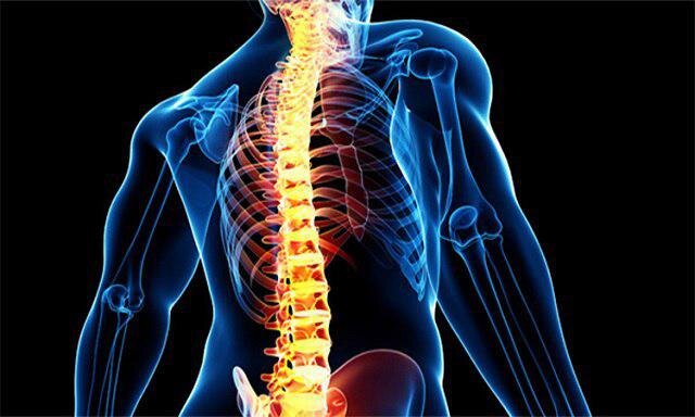 کایفوزیس باعث خستگی زودرس می‌شود