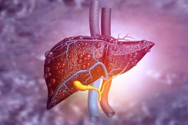 با ترکیب تمرین بدنی و ژل رویال کبد خود را متعادل کنید